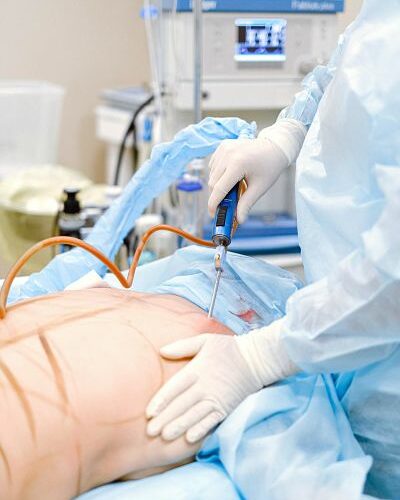 Back liposuction: what is it and what do the results look like?