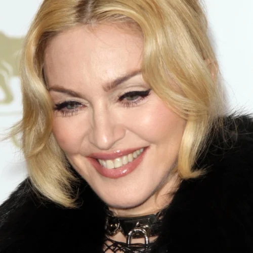 Madonna’s Excessive Cosmetic Surgeries