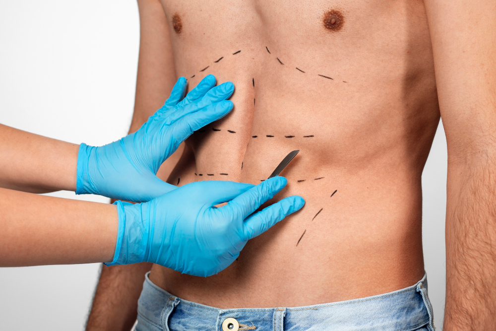 Reid Ewing Cirugías: ¿Cuántas se ha hecho y cómo ha lidiado con su dismorfia corporal? 