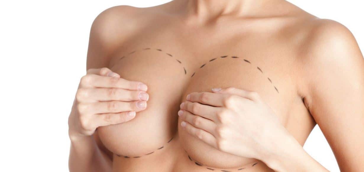 ¿Cuándo podemos optar por un Lipofilling de senos?