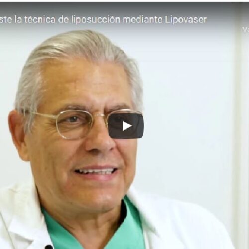 Learn what Lipovaser is and what its benefits are