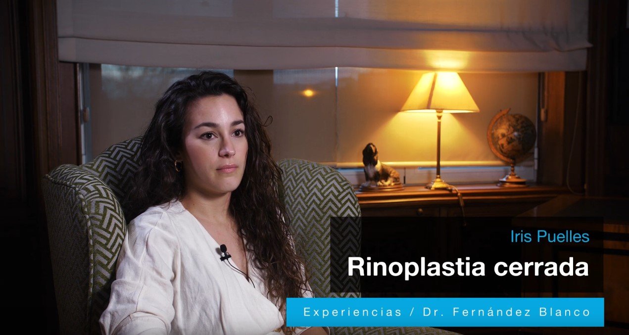 Paciente femenina nos cuenta su experiencia sobre la rinoplastia cerrada que se realizó en la Clínica FB