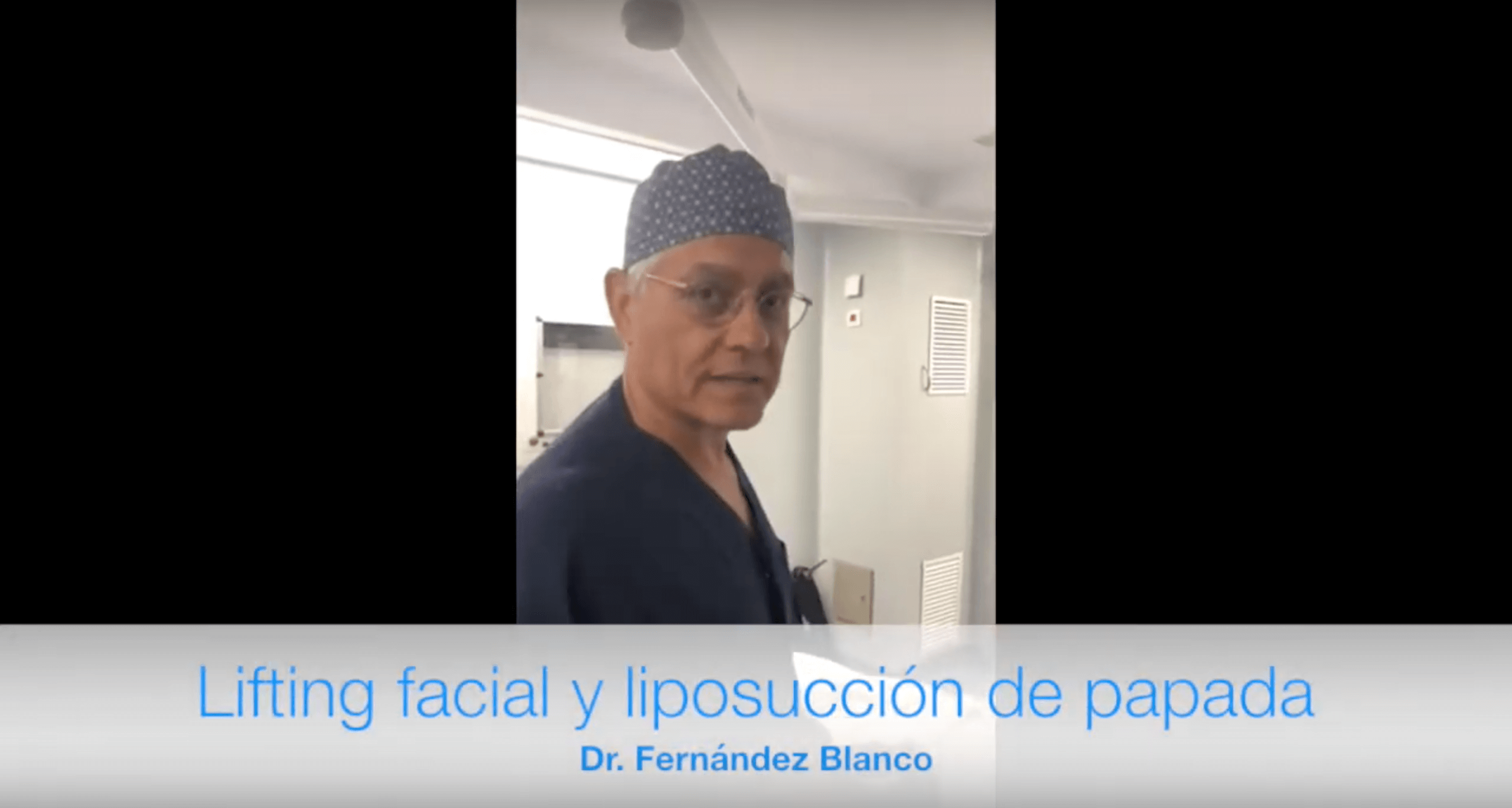 Nuestro doctor Fernández Blanco nos muestra cómo luce una paciente de lifting y liposucción de papada al día siguiente de la cirugía