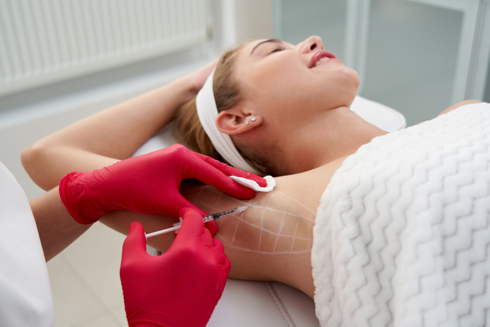 Bótox hiperhidrosis: ¿Realmente sirve como tratamiento contra la sudoración excesiva?