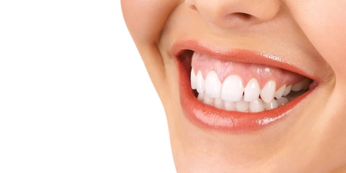 Medicina Estética: ¿Cómo se arregla la sonrisa gingival?