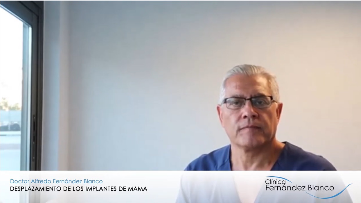 Videoblog acerca del desplazamiento de los implantes de mama luego de un aumento de pecho