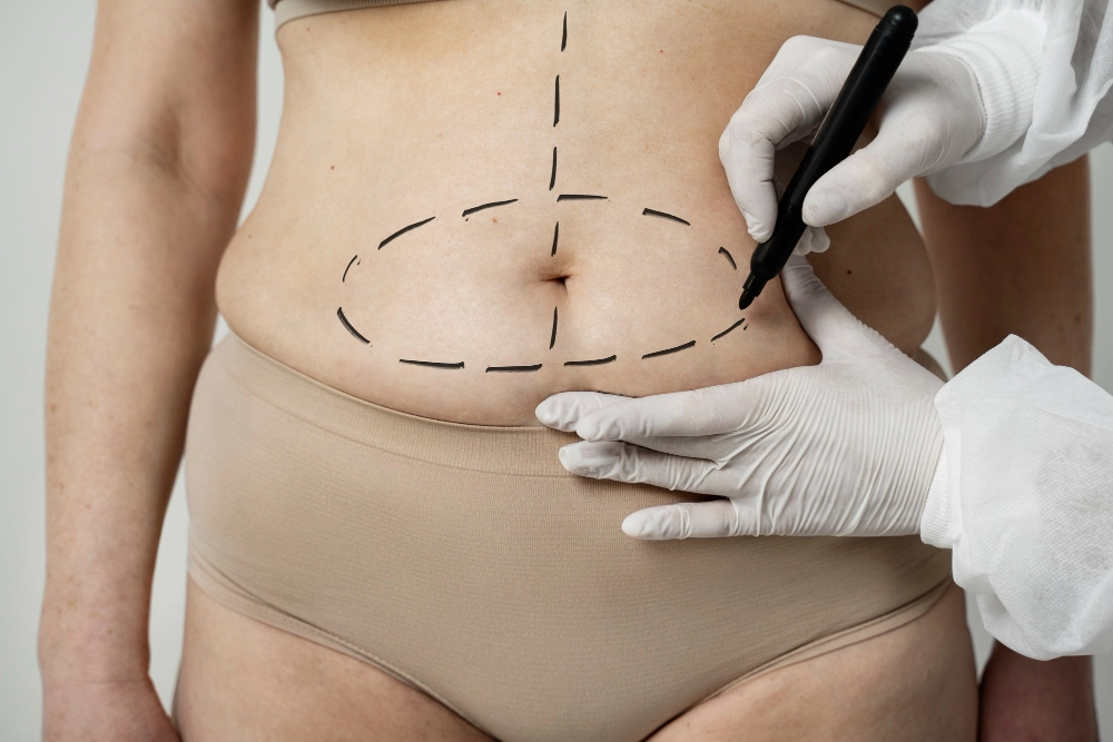 Difference between traditional and ultrasonic liposuction