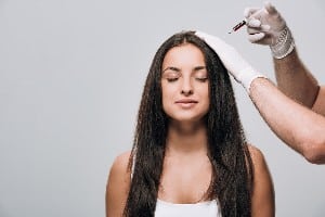 Caída del cabello: la mesoterapia capilar