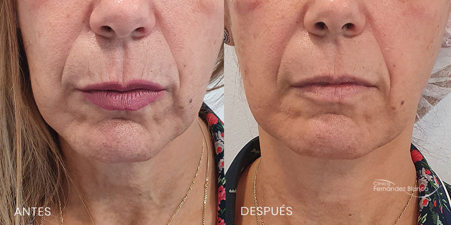 Tensor threads reviews