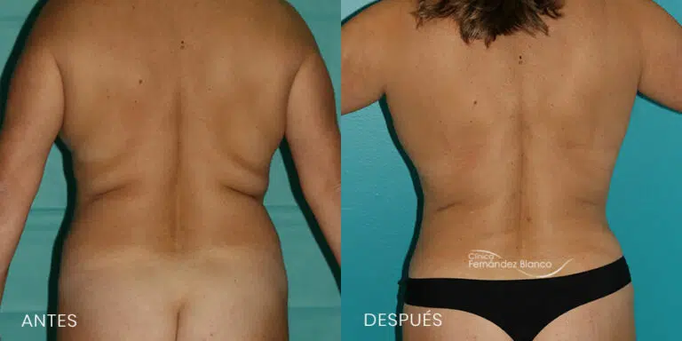 How to get a small waist