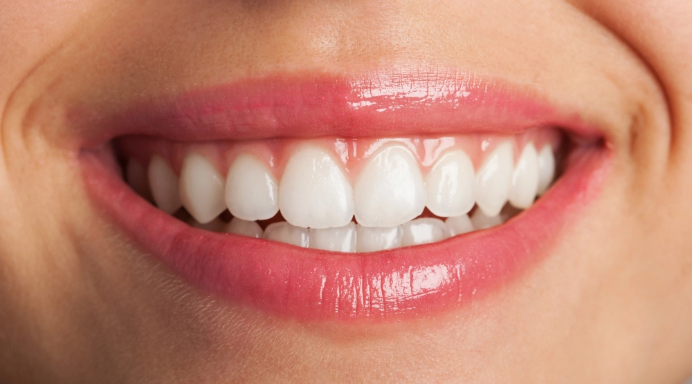 What are the causes of a Gummy Smile?