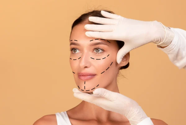 Mujer con líneas guías antes de realizarse una cirugía facial en la Clínica FB