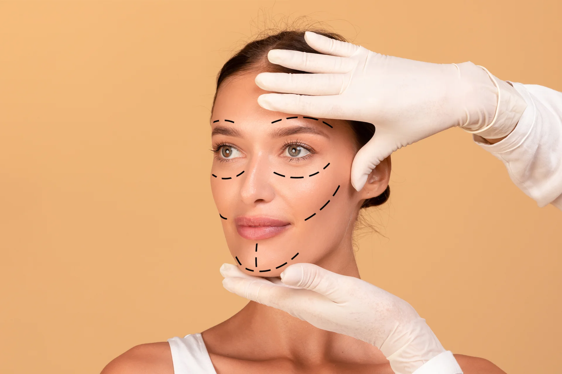 Mujer con líneas guías antes de realizarse una cirugía facial en la Clínica FB
