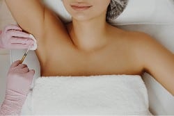 Botox: el tratamiento más eficaz para Hiperhidrosis (sudoración excesiva)
