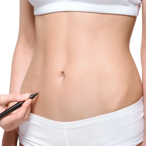 Vaser liposuction
