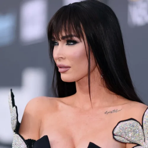 Megan Fox: how many and which cosmetic surgeries she has had