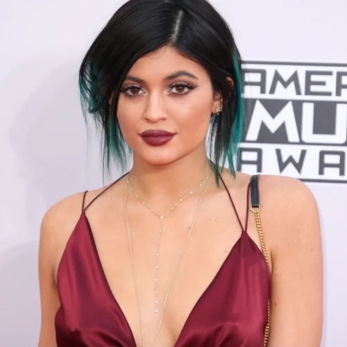 Kylie Jenner Operaciones: ¿Qué cambios la hicieron tan famosa?