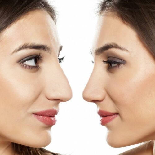 Sonnet about an attached nose