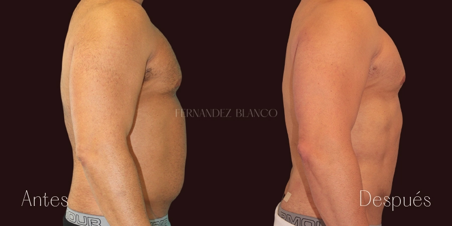 Manuel’s case