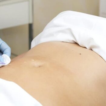 Our specialists explain whether mesotherapy can be combined with pressotherapy.