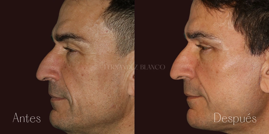 Caso de Fabricio