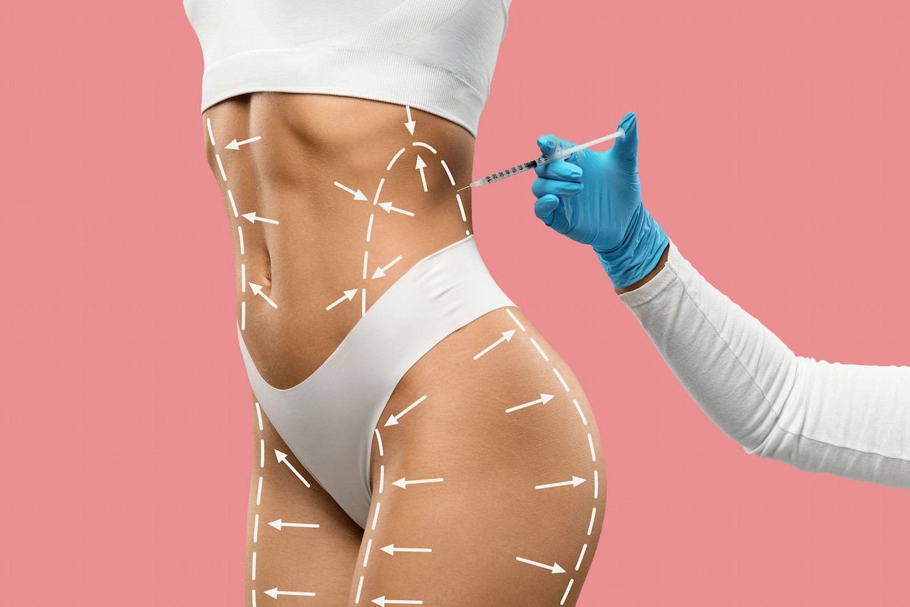 5 non-surgical liposuction treatments you should know about