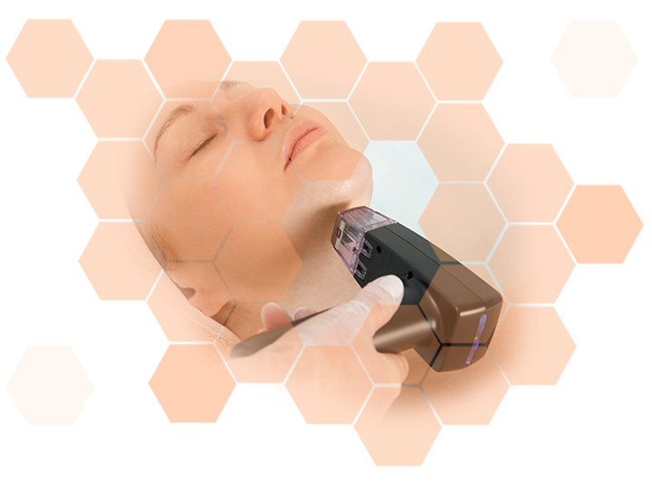 Morpheus8 price facial treatment