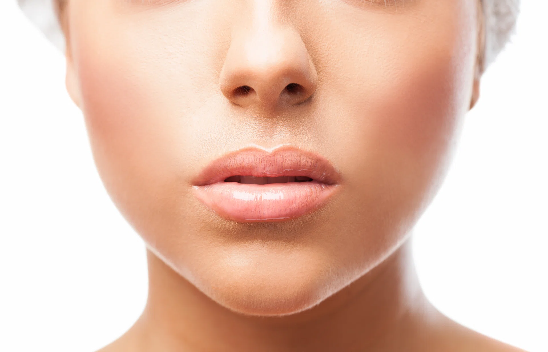 Mujer con labios naturales tras hacerse una cirugía de queiloplastia y eliminación de biopolímeros
